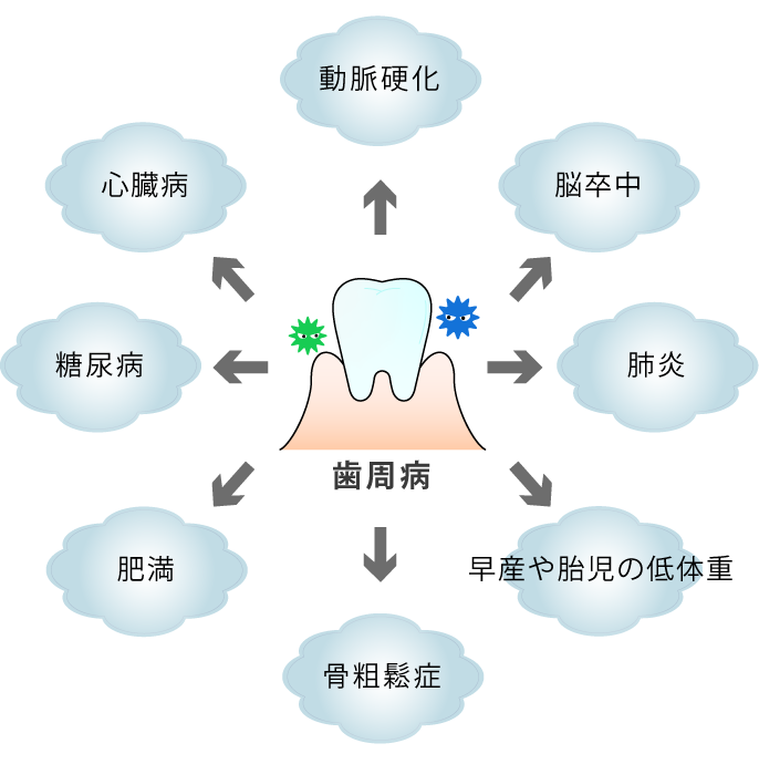 全身疾患との関係